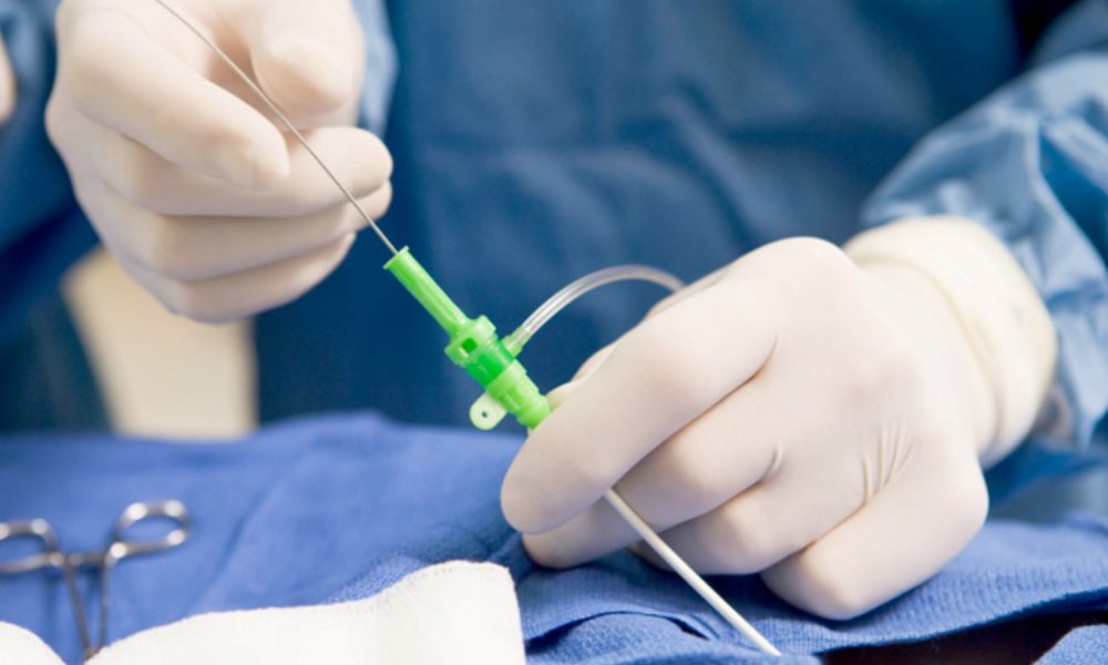 ECHA announces support for qualified restrictions on PFAS ‘forever chemicals’